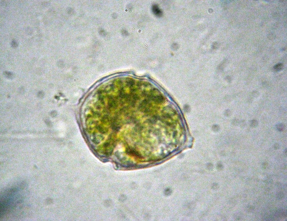Identificazione di un dinoflagellato
